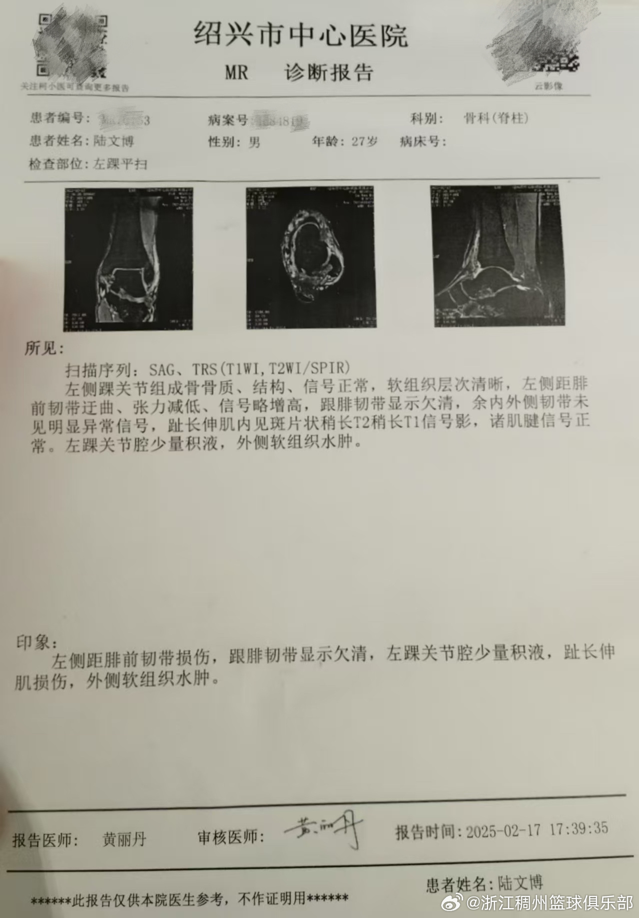 如今